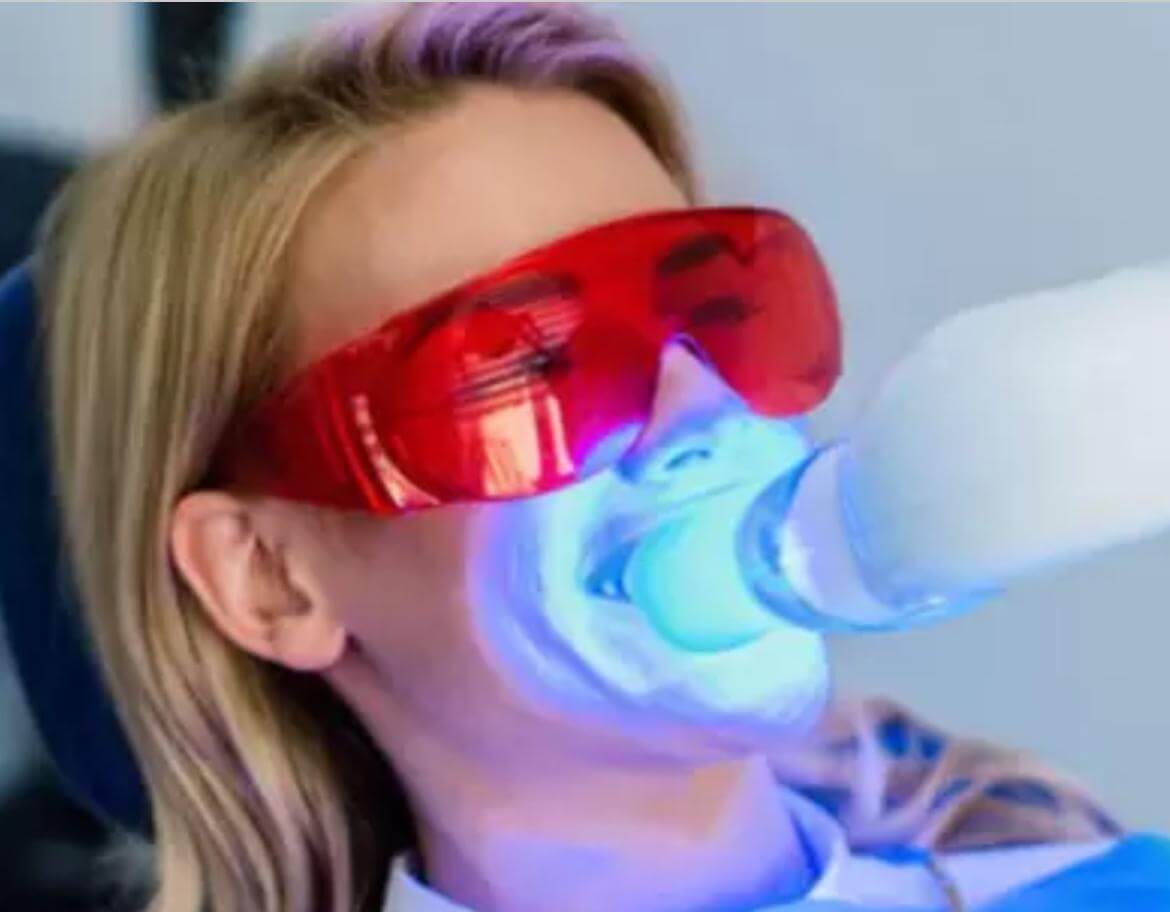 Tecnologías en odontología a domicilio | Smiles at home